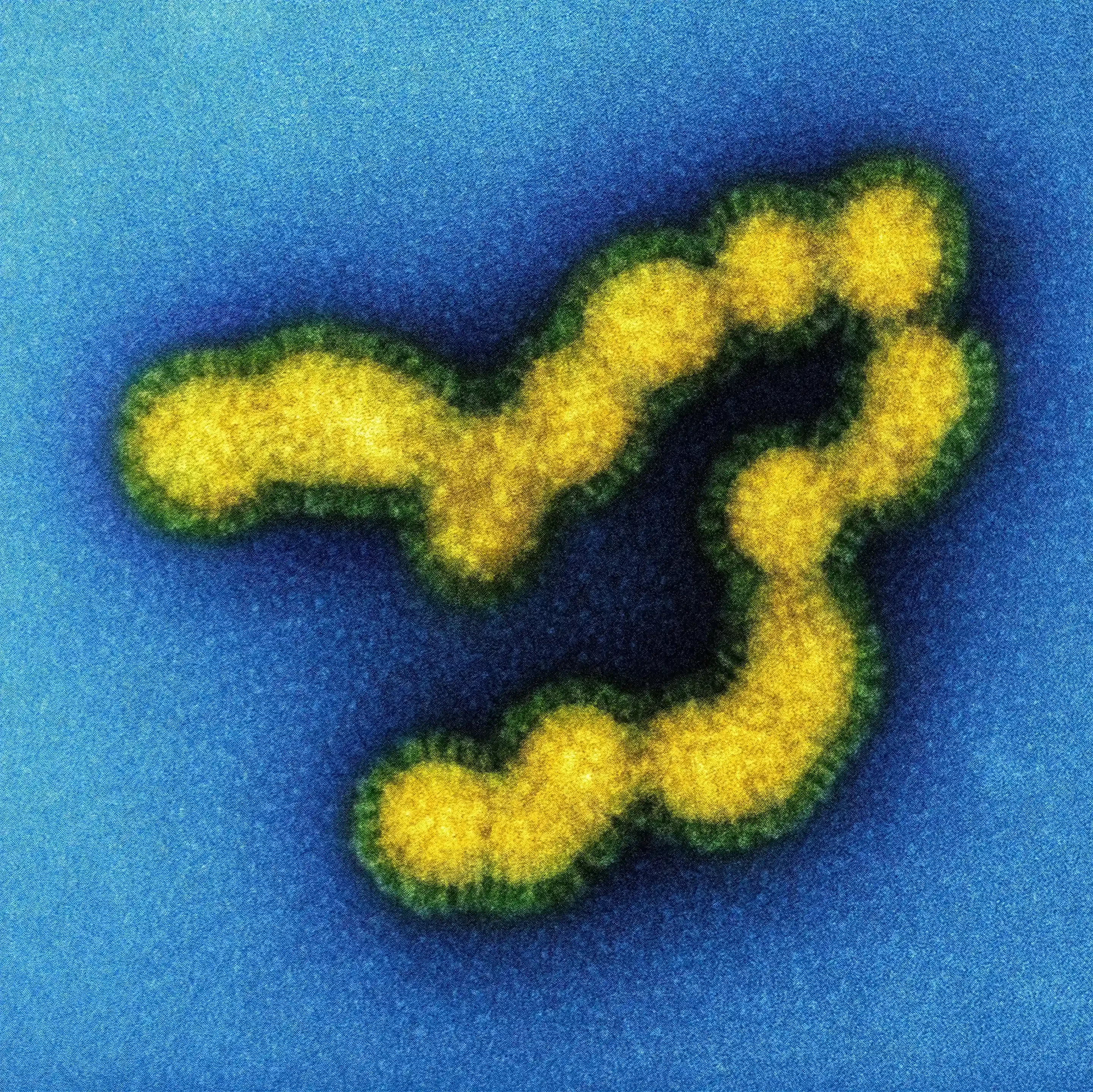 Mikroskopische Abbildung eines Grippevirus. Gelbe, kugelförmige Cluster mit einer unscharfen Textur stehen vor einem leuchtend blauen Hintergrund, der einen starken Kontrast erzeugt.